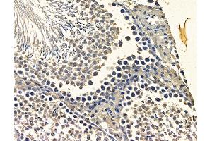 ABIN7096864 and ABIN7100930 at 1/100 staining rat testis tissue by IHC-P. (NAA25 抗体)
