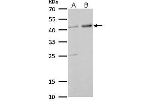 WB Image GNAS antibody [C2C3-2], C-term detects GNAS protein by Western blot analysis. (GNAS 抗体)