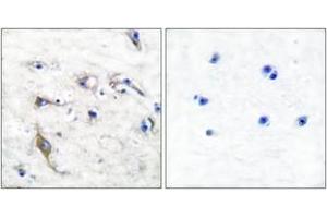 Immunohistochemistry analysis of paraffin-embedded human brain tissue, using JM4 Antibody. (PRAF2 抗体  (AA 129-178))