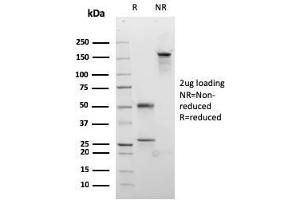 SDS-PAGE Analysis Purified Desmocollin-2/3 Recombinant Mouse Monoclonal Ab (rDSC2/3437). (Recombinant Desmocollin 2 抗体)