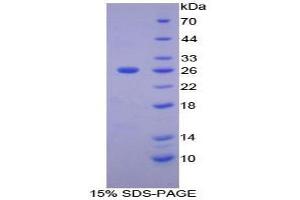 SDS-PAGE analysis of Human Matrix Metalloproteinase 11 (MMP11) Protein. (MMP11 蛋白)