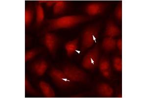 Immunofluorescence (IF) image for anti-Tubulin, beta 2B (TUBB2B) antibody (ABIN567612) (TUBB2B 抗体)