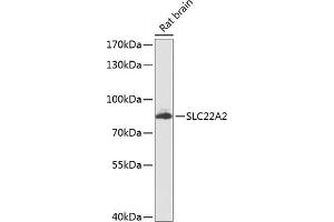 Western blot analysis of extracts of rat brain, using SLC22 antibody (ABIN6129480, ABIN6147887, ABIN6147889 and ABIN6224517) at 1:1000 dilution. (SLC22A2 抗体  (AA 44-140))