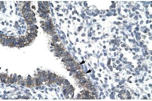 Human Lung (CCRN4L 抗体  (N-Term))