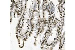IHC analysis of PRDM5 using anti-PRDM5 antibody (ABIN7600853). (PRDM5 抗体  (AA 24-630))