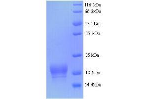 SDS-PAGE (SDS) image for Fragile Histidine Triad (FHIT) (AA 2-150) protein (His tag) (ABIN5714304)