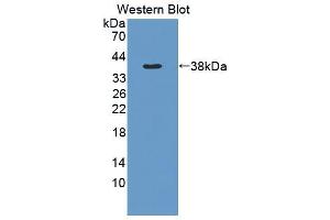 Western blot analysis of the recombinant protein. (MMP1 抗体  (AA 169-464))