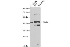 Western blot analysis of extracts of various cell lines, using UBE2U antibody (ABIN6130858, ABIN6149825, ABIN6149826 and ABIN6224418) at 1:1000 dilution. (UBE2U 抗体  (AA 1-226))
