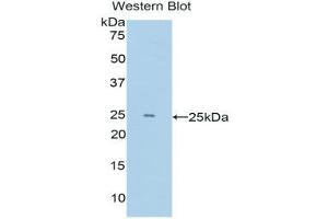 Western Blotting (WB) image for anti-Lysine (K)-Specific Demethylase 4C (KDM4C) (AA 685-871) antibody (ABIN1176553)
