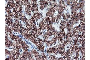 Immunohistochemistry (IHC) image for anti-Cytochrome P450, Family 2, Subfamily A, Polypeptide 6 (CYP2A6) antibody (ABIN1497724) (CYP2A6 抗体)