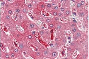 Immunohistochemistry (IHC) image for anti-Ferritin, Heavy Polypeptide 1 (FTH1) (C-Term) antibody (ABIN334401)
