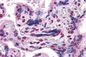 Immunohistochemistry (IHC) image for anti-Gastrulation Brain Homeo Box 2 (GBX2) (Internal Region) antibody (ABIN334408)