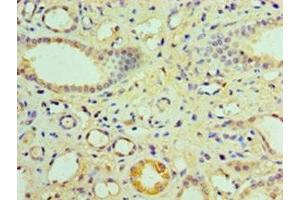 Immunohistochemistry of paraffin-embedded human kidney tissue using ABIN7161898 at dilution of 1:100 (NR1I3 抗体  (AA 2-351))