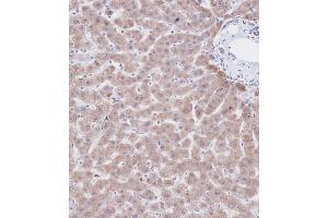 Immunohistochemistry (Paraffin-embedded Sections) (IHC (p)) image for anti-Cystathionine-beta-Synthase (CBS) (AA 301-330) antibody (ABIN390947)