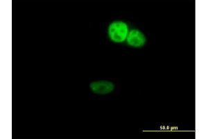 Immunofluorescence of purified MaxPab antibody to ZNF124 on HeLa cell. (ZNF124 抗体  (AA 1-289))