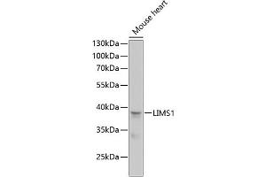 Western blot analysis of extracts of mouse heart, using LIMS1 antibody (ABIN6132048, ABIN6143232, ABIN6143234 and ABIN6218088) at 1:1000 dilution. (LIMS1 抗体  (AA 1-325))