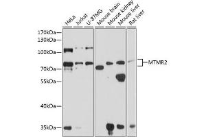 Western blot analysis of extracts of various cell lines, using MTMR2 antibody (ABIN6128322, ABIN6144156, ABIN6144157 and ABIN6224847) at 1:1000 dilution. (MTMR2 抗体  (AA 404-643))