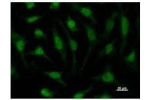 Immunostaining analysis in HeLa cells. (RUVBL1 抗体)