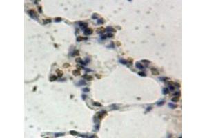IHC-P analysis of Lung tissue, with DAB staining. (SIRT1 抗体  (AA 244-498))