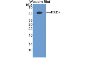 Western blot analysis of the recombinant protein. (CD97 抗体  (AA 191-304))
