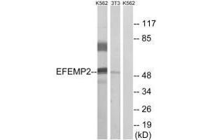 Western blot analysis of extracts from K562 cells and 3T3 cells, using EFEMP2 antibody. (FBLN4 抗体)