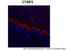 Sample Type: outer mouse plexiform layerRed: PrimaryBlue: DAPIPrimary Dilution: 1:200Secondary Antibody: Goat anti-Rabbit AF568 IgG(H+L)Secondary Dilution: 1:200Image Submitted by: David ZenisekYale University (CTBP2 抗体  (Middle Region))