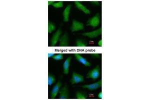 ICC/IF Image Immunofluorescence analysis of paraformaldehyde-fixed HeLa, using 20S Proteasome alpha 6, antibody at 1:200 dilution. (PSMA6 抗体  (Center))
