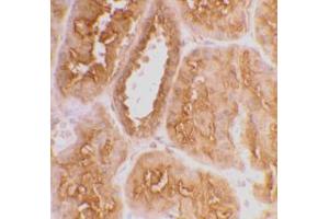 Immunohistochemical staining of human kidney tissue using AP30007PU-N ACE2 antibody at 2 μg/ml. (ACE2 抗体  (C-Term))