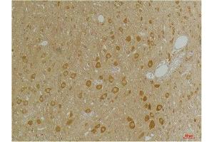 Immunohistochemical analysis of paraffin-embedded Rat BrainTissue using GABA A Receptor α3 Rabbit pAb diluted at 1:200. (GABRA3 抗体)