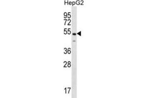 Western Blotting (WB) image for anti-NFKB Activating Protein (NKAP) antibody (ABIN2996720) (NKAP 抗体)