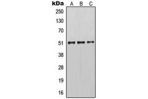 Western blot analysis of Cytokeratin 14 expression in MCF7 (A), mouse brain (B), rat brain (C) whole cell lysates. (KRT14 抗体  (N-Term))