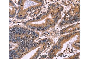Immunohistochemistry of Human brain  using S100A13 Polyclonal Antibody at dilution of 1:40 (S100A13 抗体)