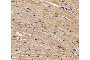 Immunohistochemistry analysis of paraffin-embedded mouse heart using,TMP1 (ABIN7076030) at dilution of 1: 1600 (Tropomyosin 抗体)