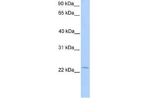 Human Placenta; WB Suggested Anti-C5orf39 Antibody Titration: 0. (Chromosome 5 Open Reading Frame 39 (C5orf39) (N-Term) 抗体)