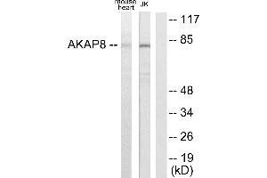 Immunohistochemistry analysis of paraffin-embedded human heart tissue using AKAP8 antibody.