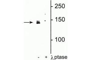 Western blot of HeLa cell lysate showing specific immunolabeling of the ~142 kDa DENND3 protein phosphorylated at Ser554 in the first lane (-). (DENND3 抗体  (pSer554))