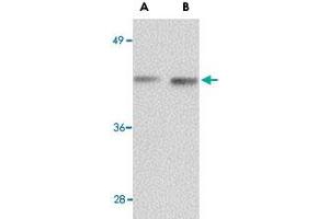 Western blot analysis of NANOS1 in rat brain tissue lysate with NANOS1 polyclonal antibody  at (A) 1 and (B) 2 ug/mL . (Nanos Homolog 1 抗体  (Internal Region))