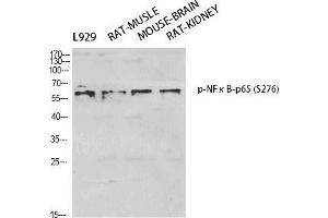 Western Blot (WB) analysis of specific cells using Phospho-NFkappaB-p65 (S276) Polyclonal Antibody.