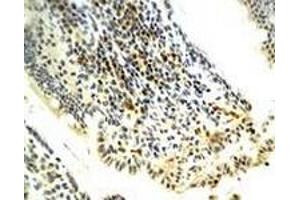 Immunohistochemiacl staining of rat model of Necrotizing Enterocolitis (NEC) tissue section with PNOC polyclonal antibody  at 1:400 dilution. (PNOC 抗体)