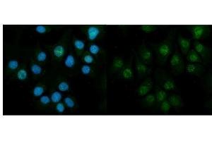 IF analysis of CBS using anti-CBS antibody (ABIN7599637).