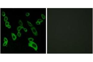 Immunofluorescence analysis of LOVO cells, using GPR139 Antibody. (GPR139 抗体  (AA 181-230))