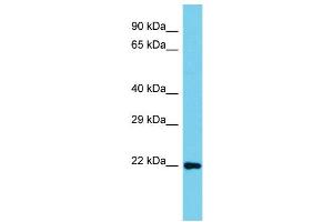 Host: Rabbit Target Name: C8orf33 Sample Type: Jurkat Whole Cell lysates Antibody Dilution: 1. (C8orf33 抗体  (C-Term))