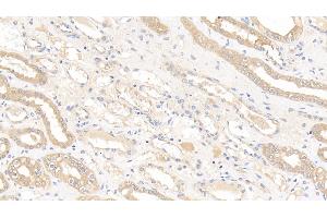 Detection of GSTM1 in Human Kidney Tissue using Polyclonal Antibody to Glutathione S Transferase Mu 1 (GSTM1) (GSTM1 抗体  (AA 1-218))
