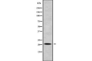 Western blot analysis of RABL5 using A549 whole cell lysates (RABL5 抗体  (Internal Region))