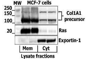Western Blotting (WB) image for anti-Collagen, Type I (COL1) (AA 1051-1150) antibody (ABIN2173309)