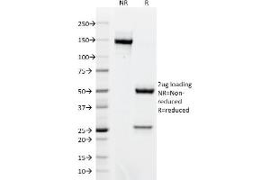 SDS-PAGE Analysis Purified BCL-6 Mouse Monoclonal Antibody (BCL6/1718). (BCL6 抗体  (AA 256-389))