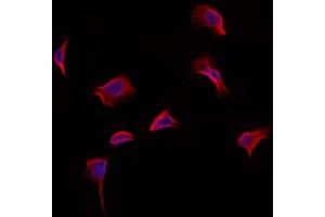ABIN6265330 and ABIN6273170 staining Hela by IF/ICC.