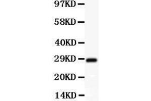 Anti-SCP3 Picoband antibody,  All lanes: Anti SCP3  at 0. (SYCP3 抗体  (AA 18-223))