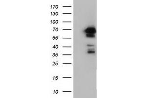 Western Blotting (WB) image for anti-Adenylate Kinase 5 (AK5) antibody (ABIN1496533) (Adenylate Kinase 5 抗体)