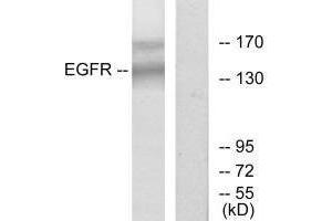 Western blot analysis of extracts from HT-29 cells, using EGFR (Ab-1172) antibody. (EGFR 抗体  (Tyr1172))